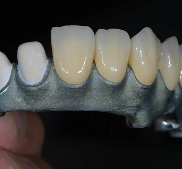 fogpótlás fogászat